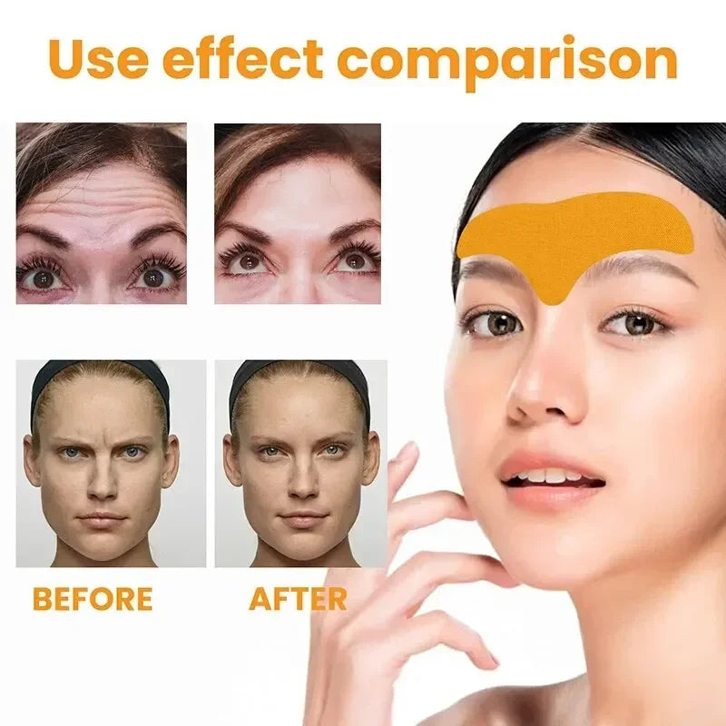 The Forehead Wrinkle Patch